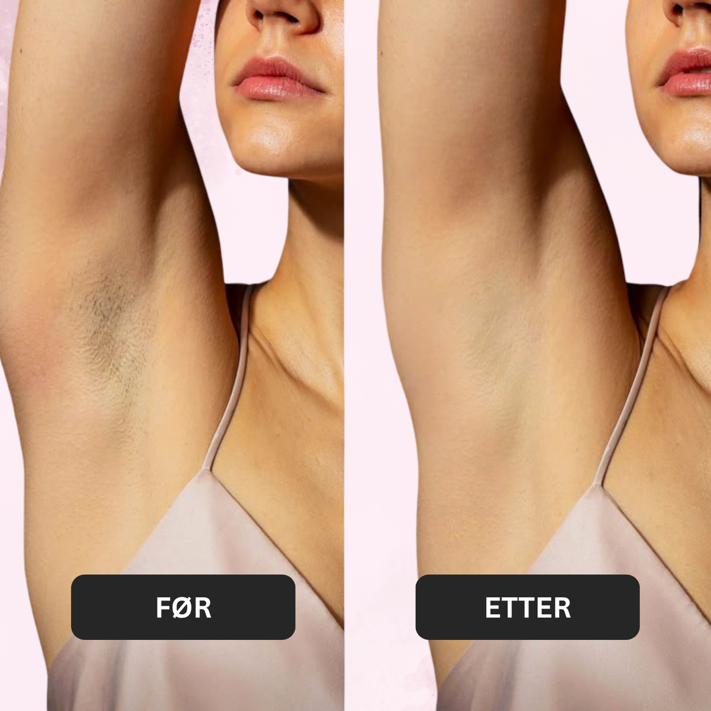 Natural Sugaring Hair Removal Paste