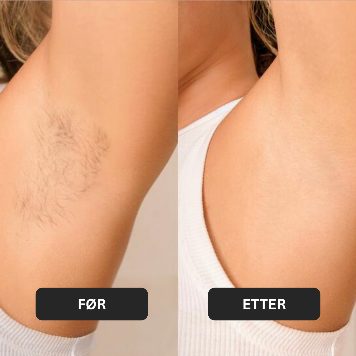 Natural Sugaring Hair Removal Paste